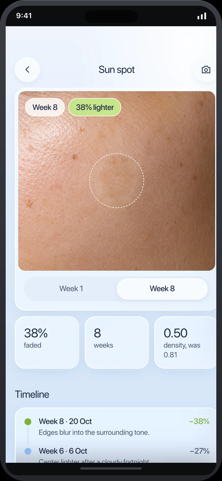 Shadelle (AI Melanin, UV & Sun Care Advisor) — Spot Detail
