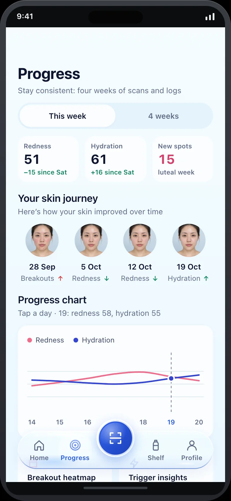 Dewlog (AI Skin Diary & Trigger Tracker) — Progress