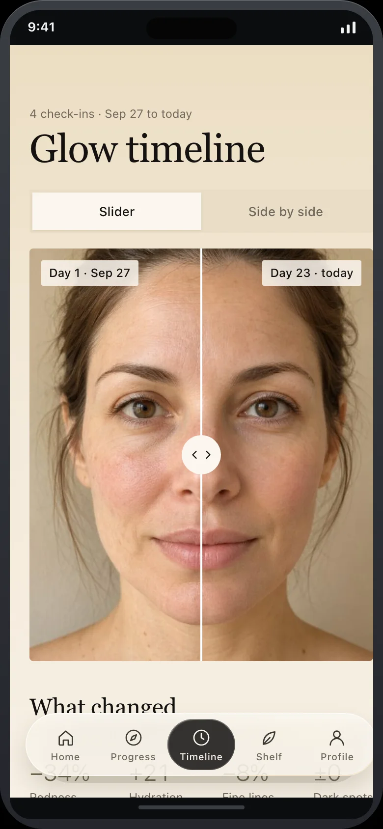 Velline (AI Skin Glow & Anti-Aging Tracker) — Timeline