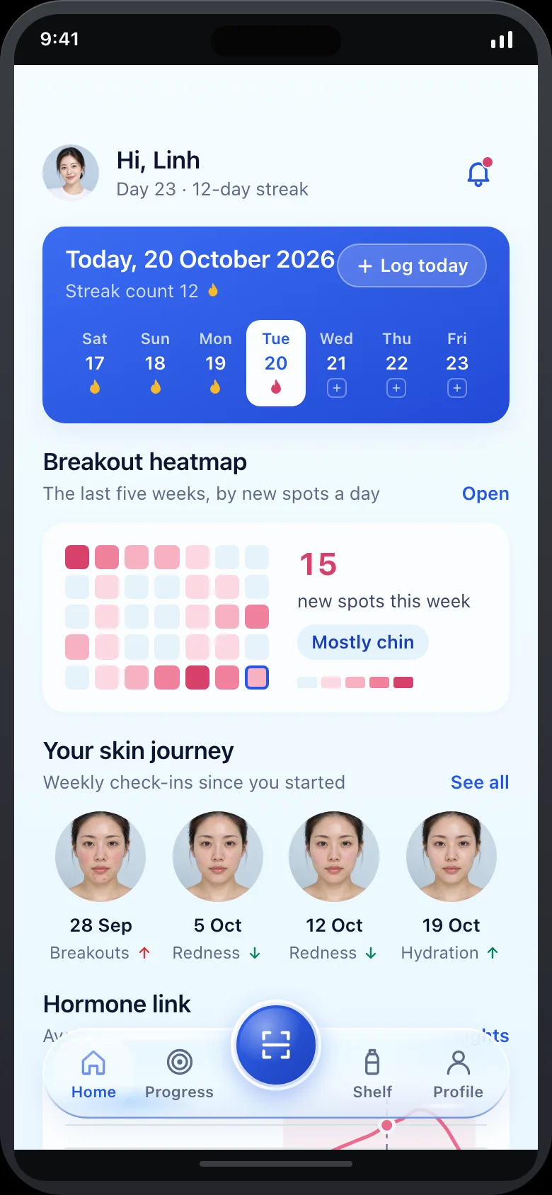 Dewlog (AI Skin Diary & Trigger Tracker) — Home